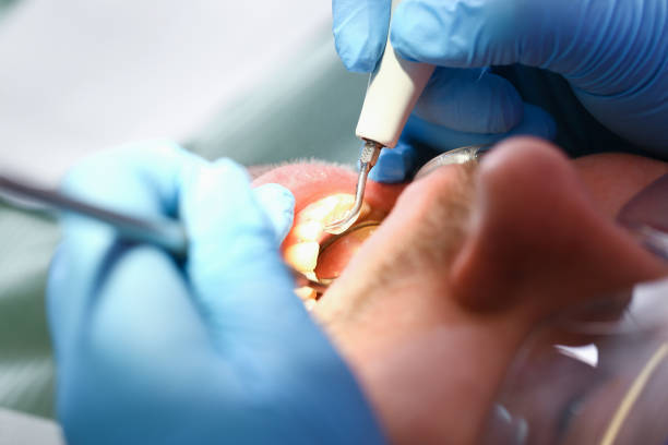 Best Knocked-Out Tooth Emergency  in Collinwood, TN